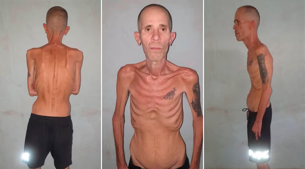 Las impactantes imágenes de un preso político cubano al salir de prisión luego de cinco años